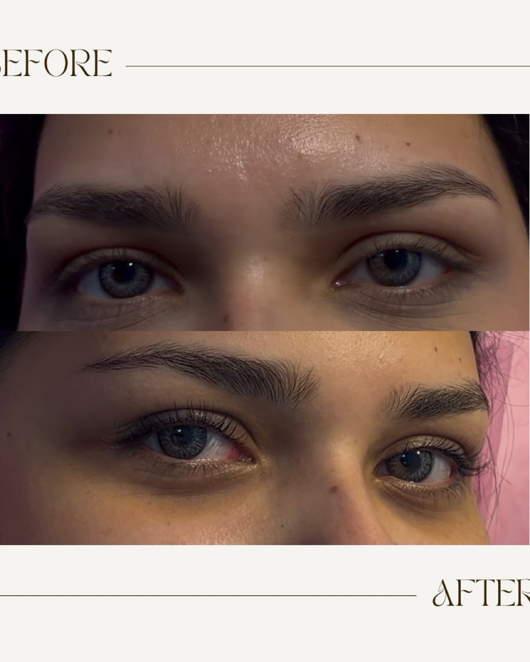 Lash lifts 